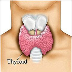 Bolile glandei tiroide - hipertiroidism, hipotiroidism